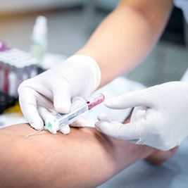 Blood Collection Systems